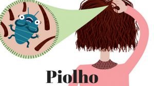 piolho