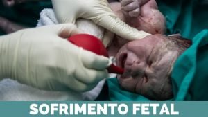 sofrimento fetal